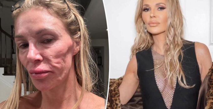 Parasite possible à l'origine de déformation faciale, Brandi Glanville.