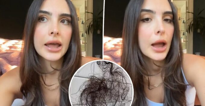 Sophia, fille de Kyle Richards, montre perte cheveux à cause